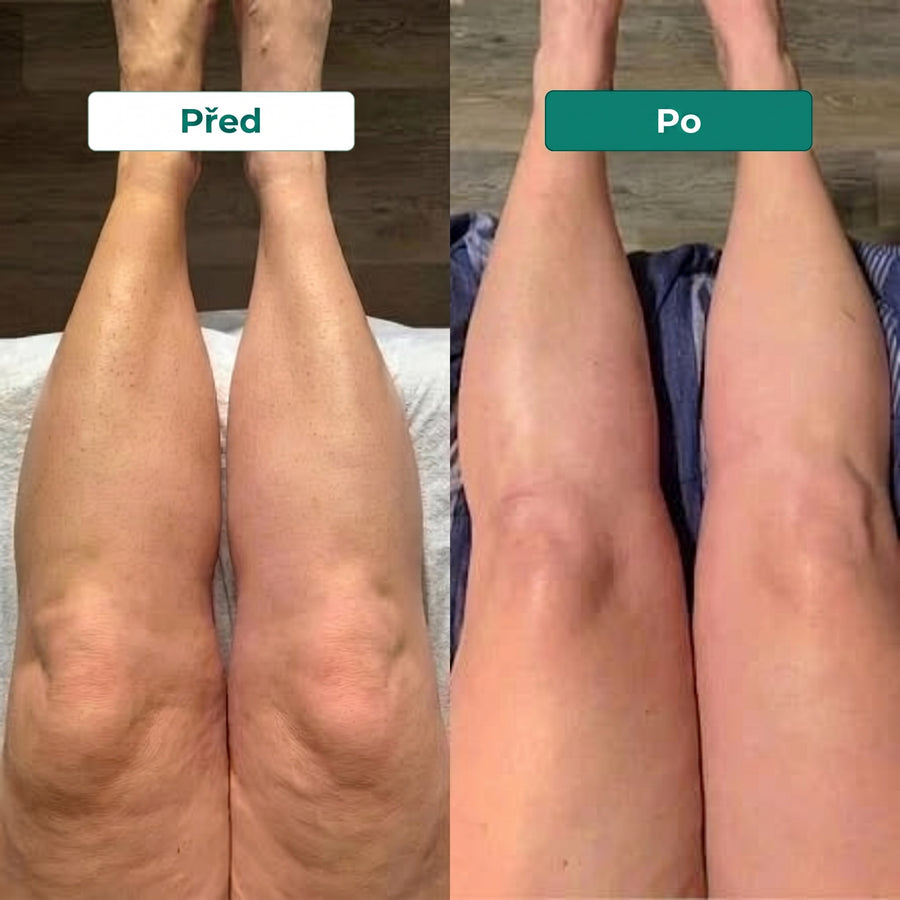 Customer before and after result